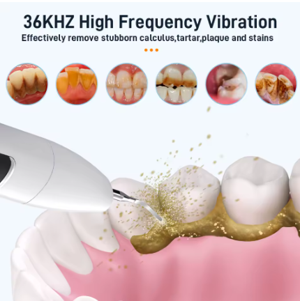 Electric Sonic Dental Calculus Scale